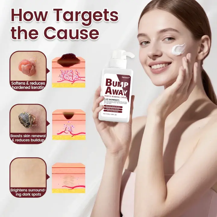 BumpAway Gentle Renewal Cream - Image 4