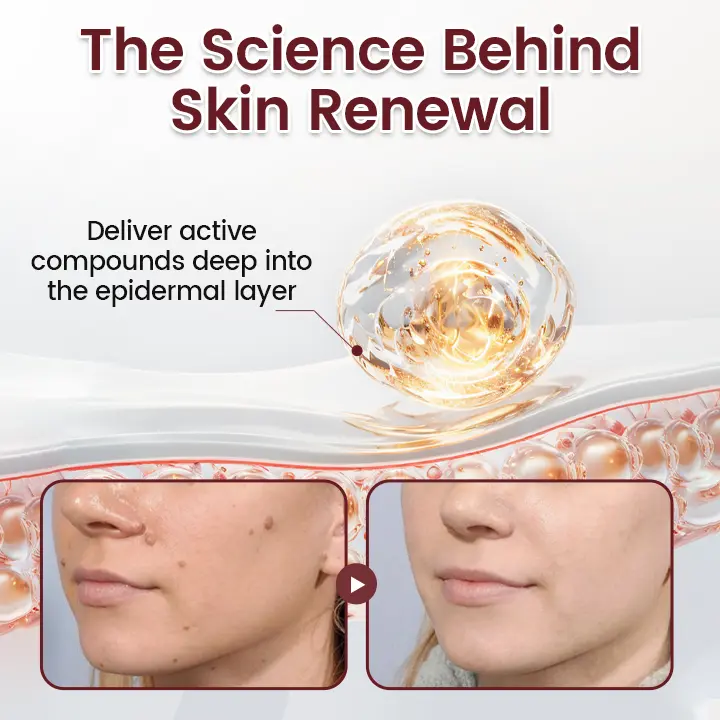 BumpAway Gentle Renewal Cream - Image 5