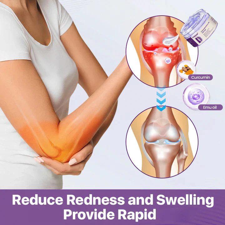 Curcumin Emu Oil Pain Gel - Image 3