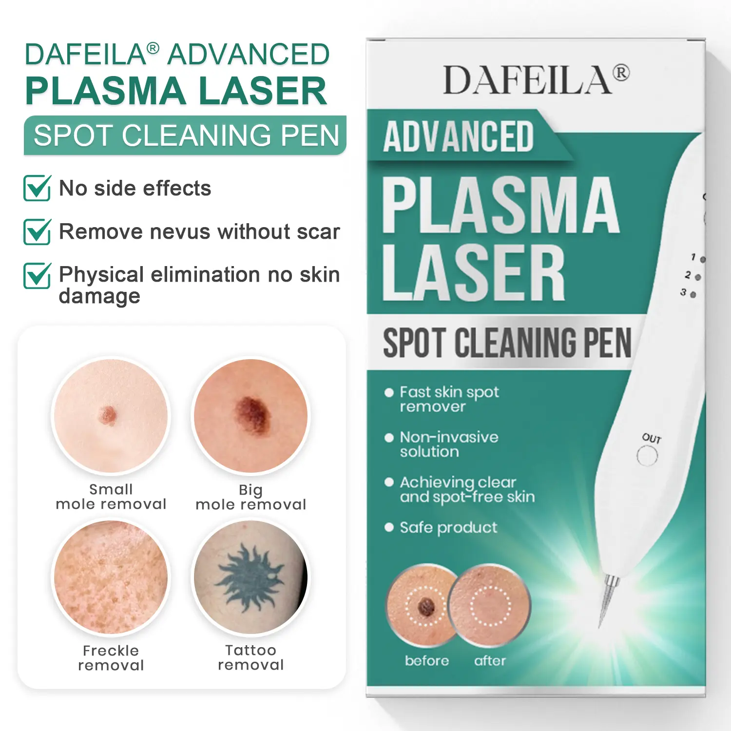 Advanced Plasma Laser Spot Cleaning Pen - Image 2