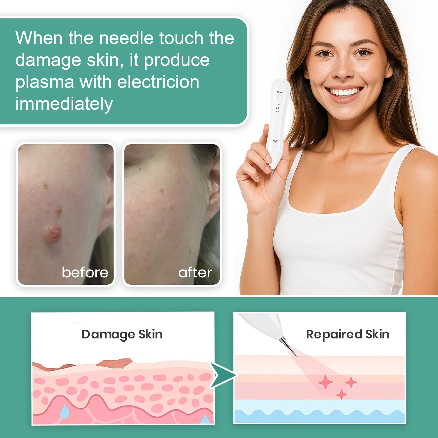 Advanced Plasma Laser Spot Cleaning Pen - Image 4