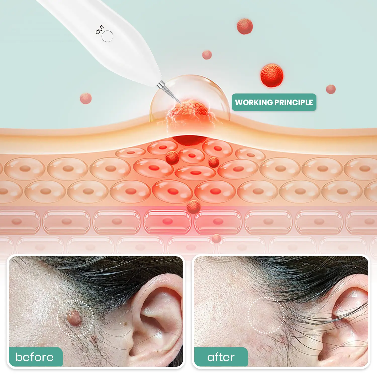 Advanced Plasma Laser Spot Cleaning Pen - Image 5