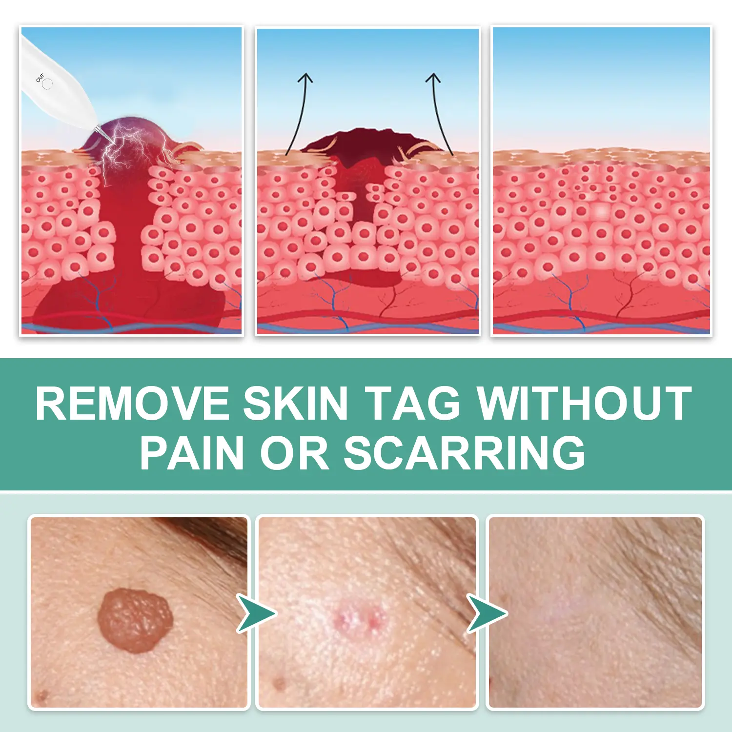 Advanced Plasma Laser Spot Cleaning Pen - Image 6