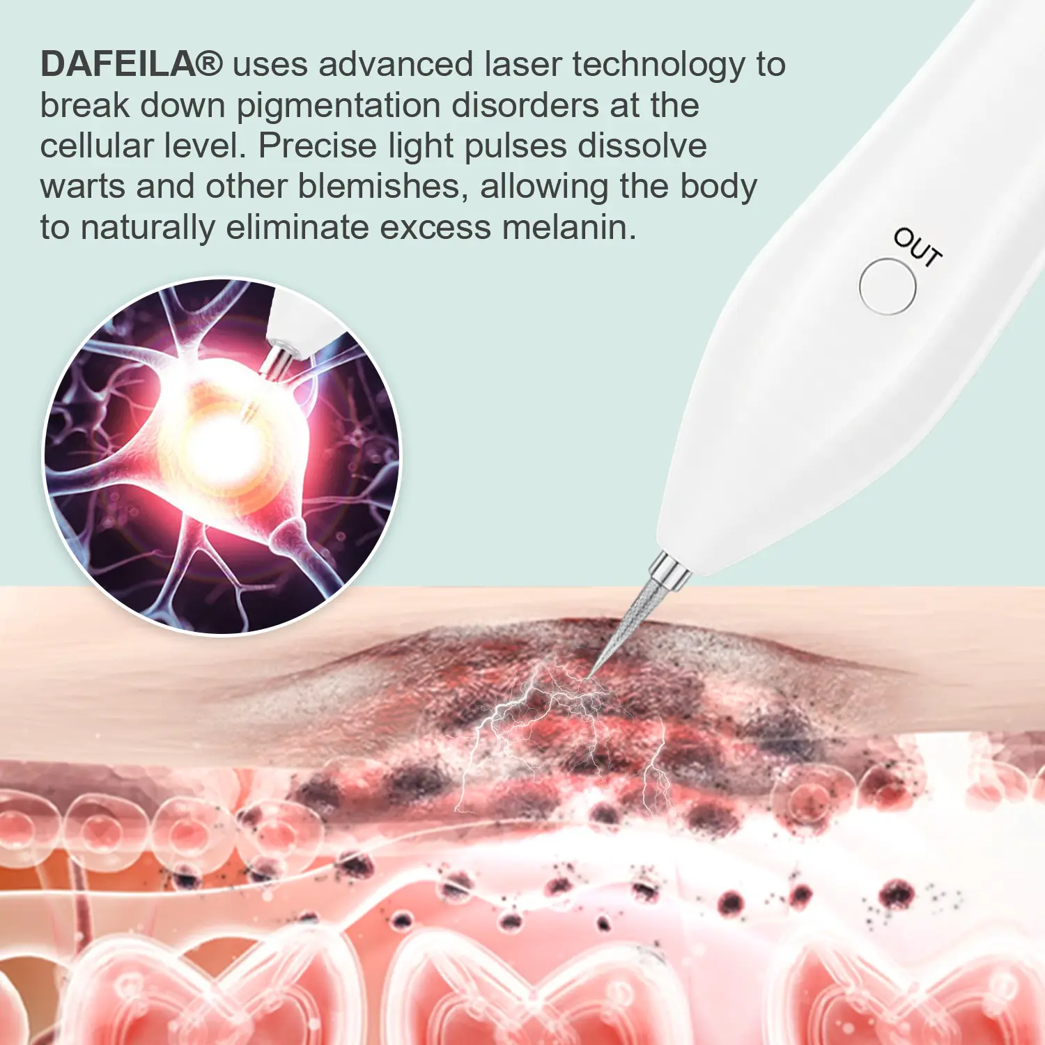 Advanced Plasma Laser Spot Cleaning Pen - Image 7