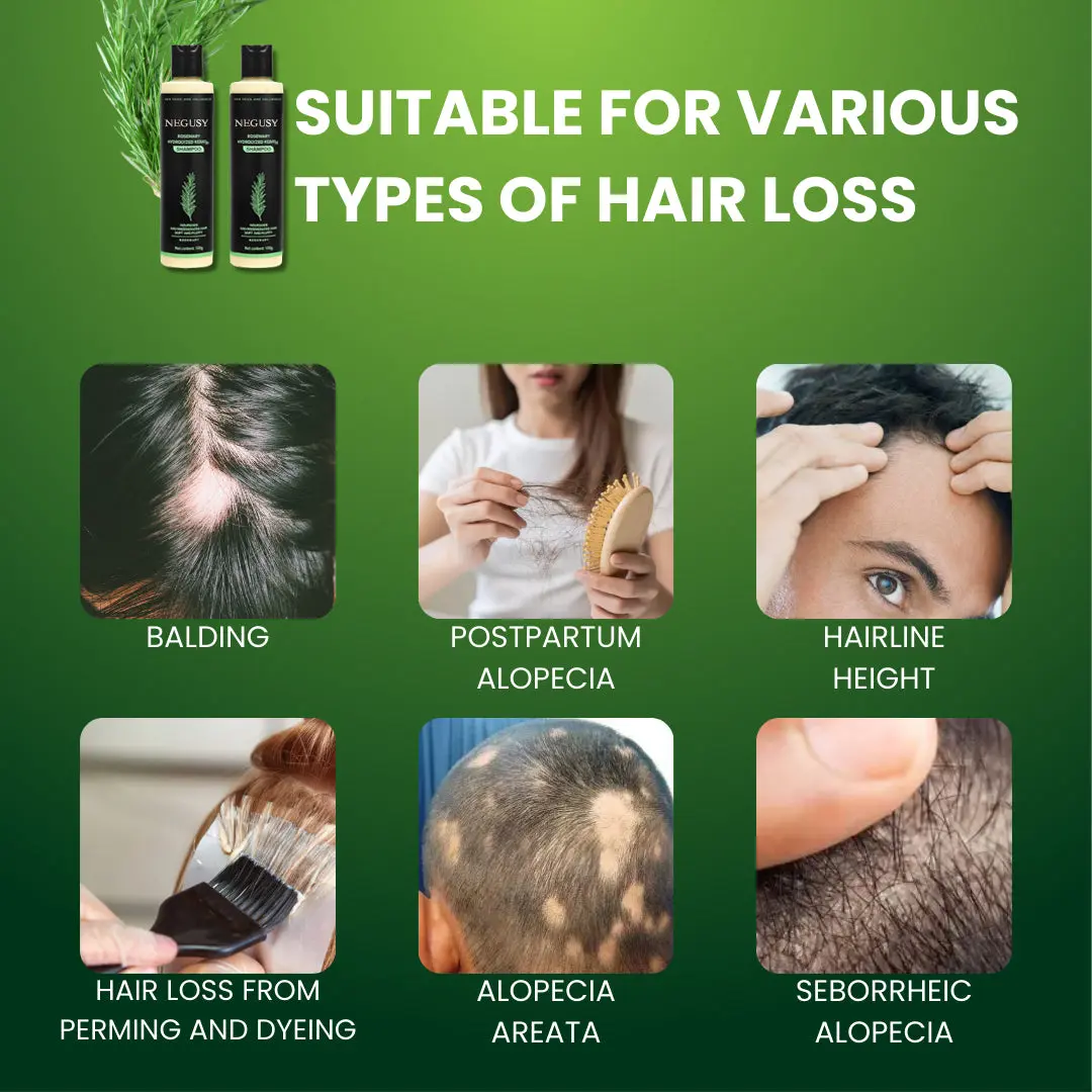 NEGUSY Rosemary Keratin Repair Shampoo for Thicker, Stronger Hair Reduce Breakage Save Up to 40 Today - Image 5