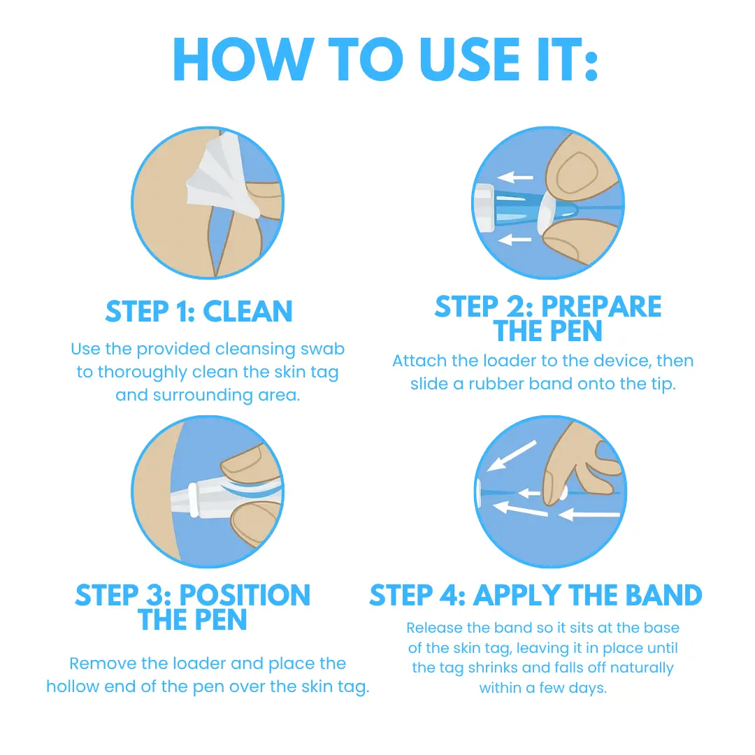 Skin Tag Removal Pen ACE - Image 7