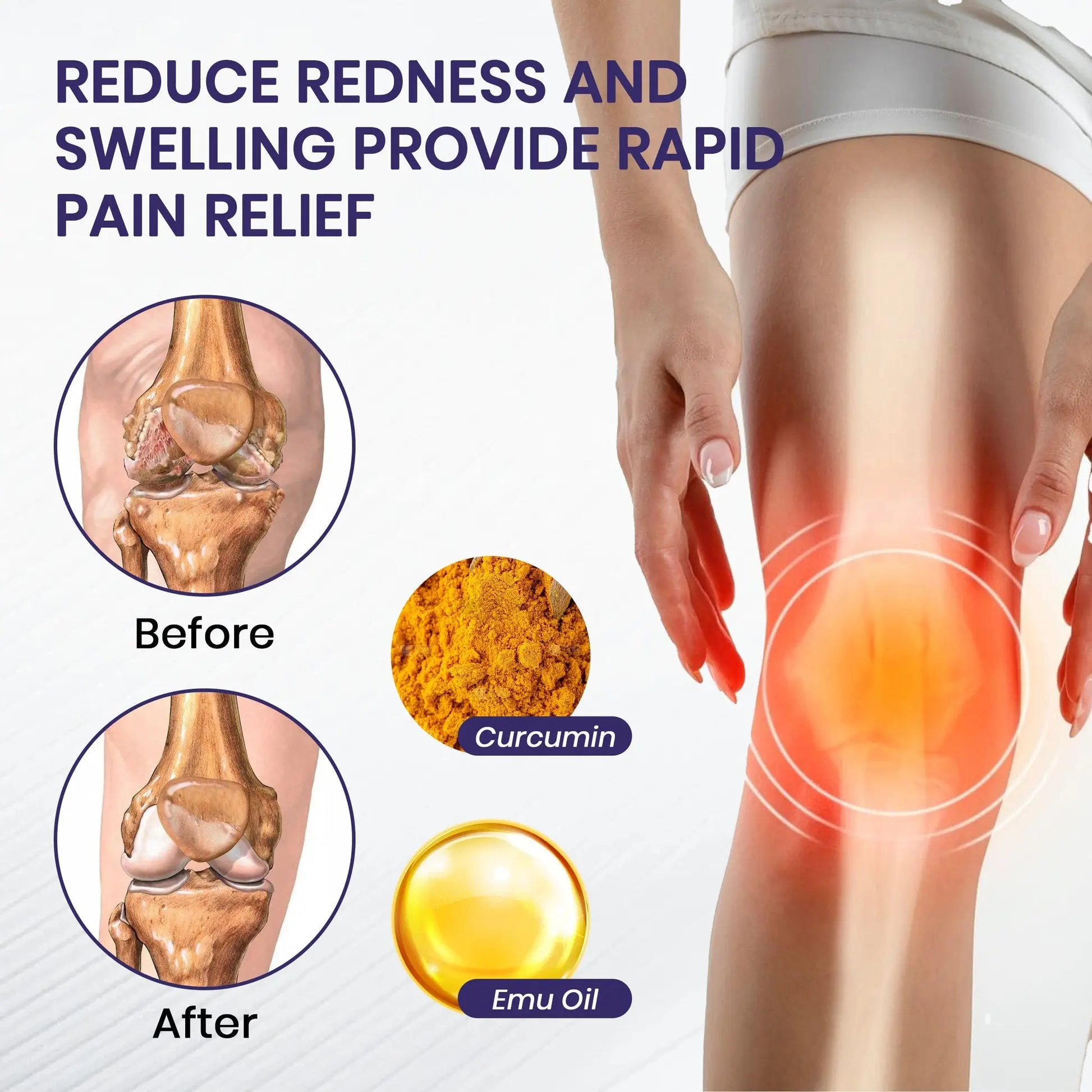 Turmeric & Emu Oil Arthritis Soothing Pain Relief Massage - Image 5