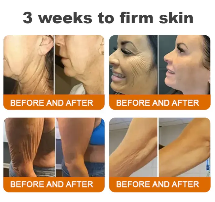 Bee venom Comprehensive Cream - Image 3