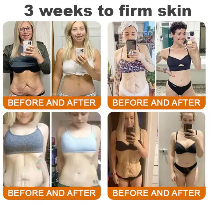 Bee venom Comprehensive Cream - Image 4