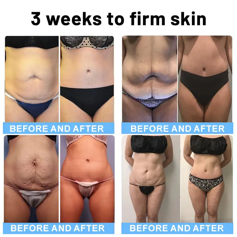 Botox Bee Venom Firming Serum Stick - Image 2