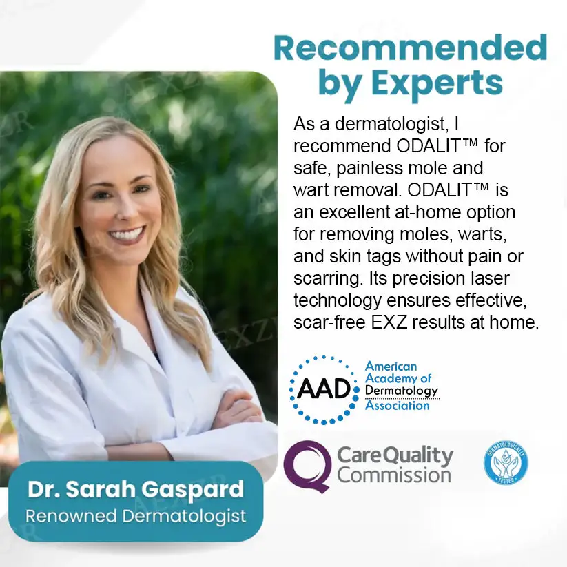 Non-Invasive Mole and Wart Removal Laser Pen - Image 4