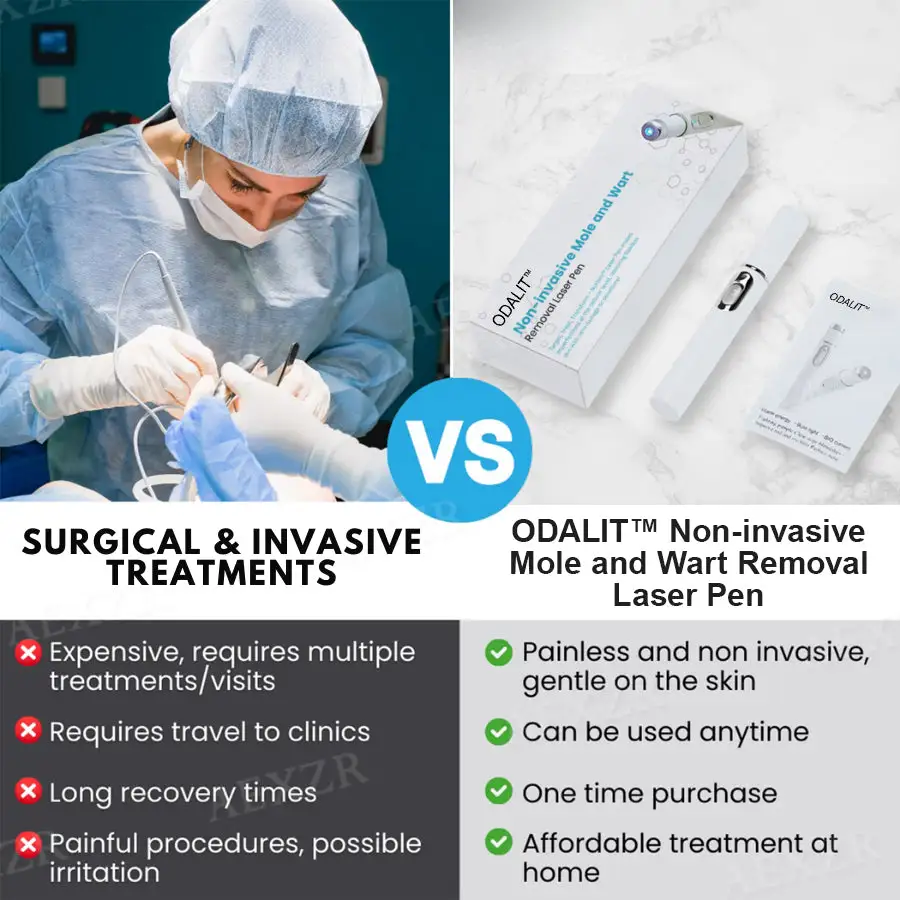Non-Invasive Mole and Wart Removal Laser Pen - Image 9