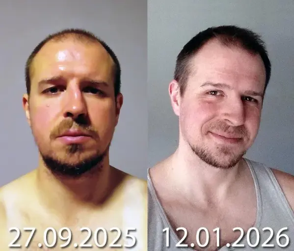 Patches | Beat your alcohol cravings in just 7 days, hassle-free - Image 9