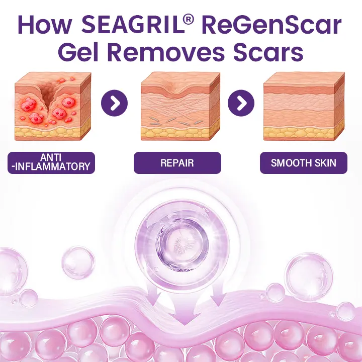 ReGenScar Stem Cell Scar Gel - Image 5