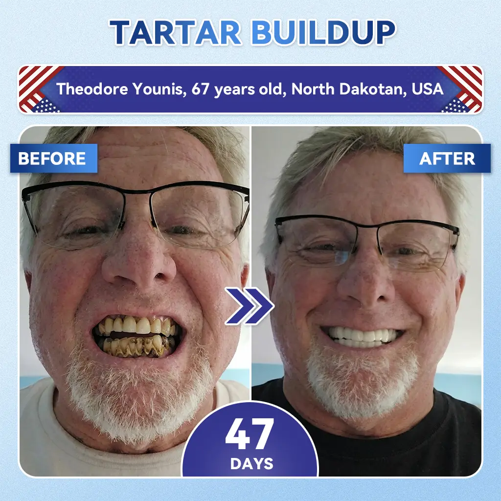 ๐๐จ๐จ๐ญ๐ก & ๐๐ฎ๐ฆ ๐๐๐ฉ๐๐ข๐ซ ๐๐ข๐๐ซ๐จ๐ง๐๐๐๐ฅ๐ ๐๐๐ญ๐๐ก - Image 2