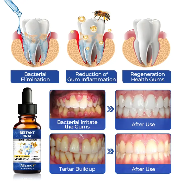 BeeTakt Oral Repair Solution - Image 13