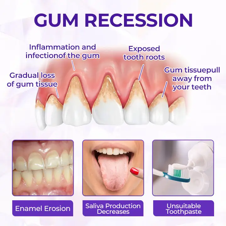 SensiGum Fluoride Toothpaste - Image 10