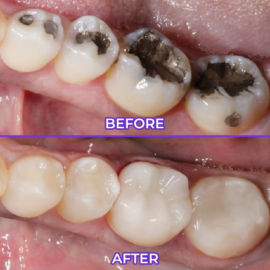 SensiGum Fluoride Toothpaste - Image 3