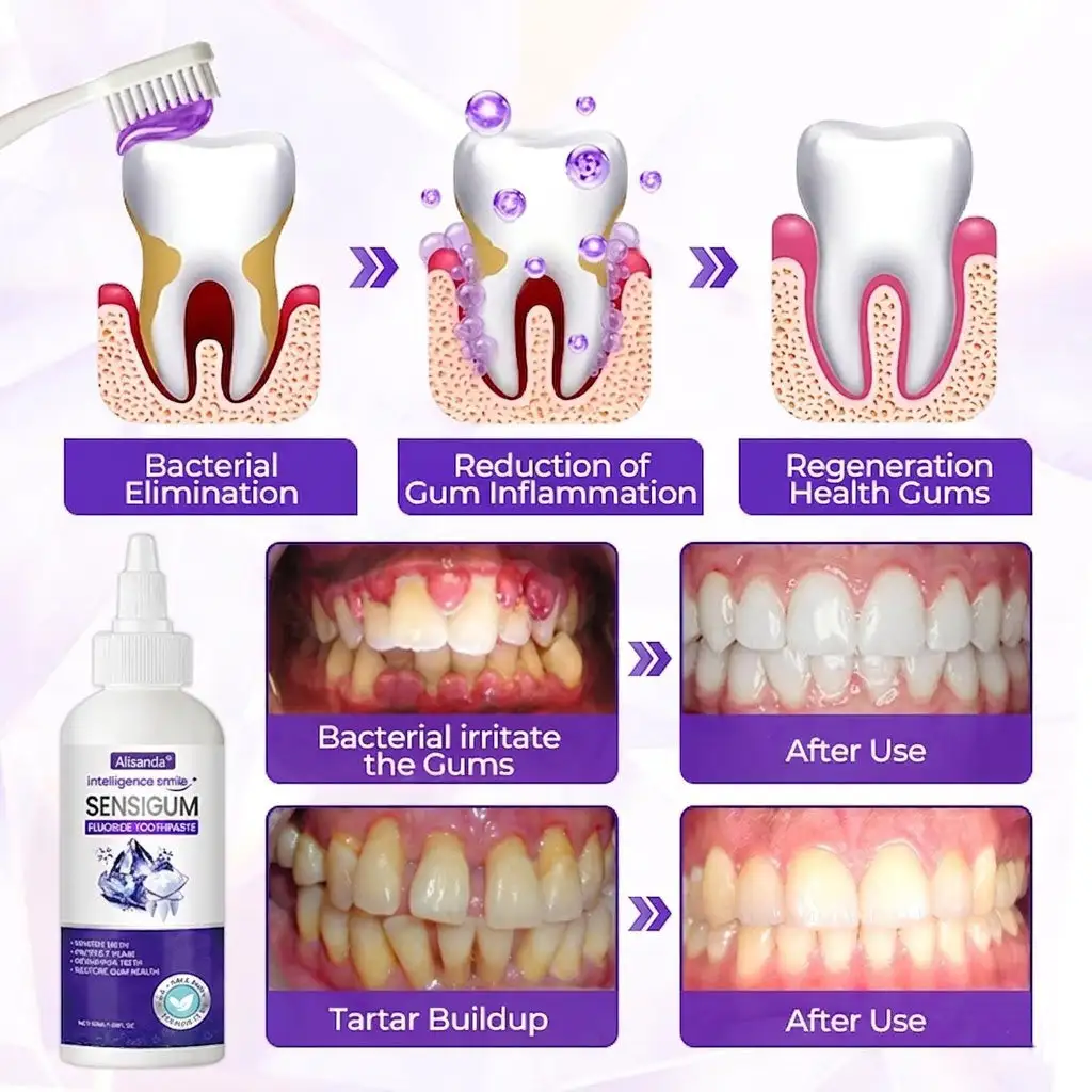 SensiGum Fluoride Toothpaste - Image 7