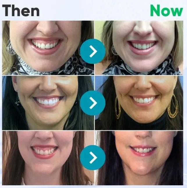 VioCore Dental Treatment Toothpaste - Image 10