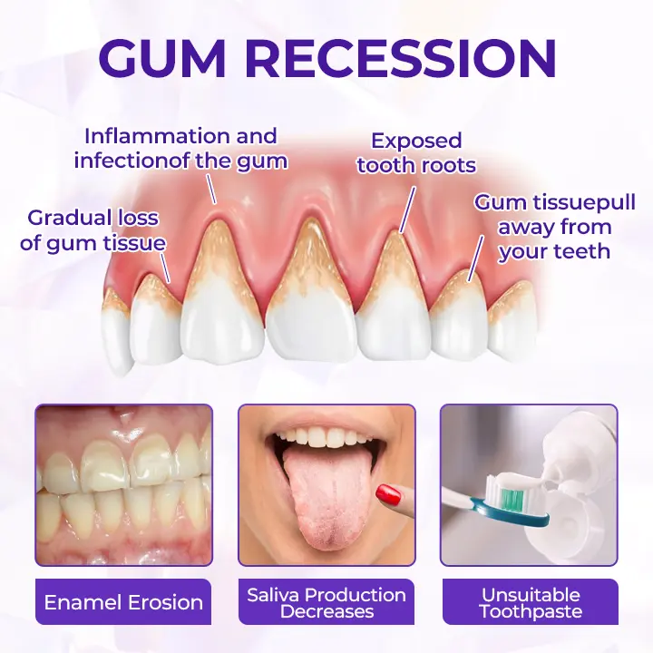 SensiGum Fluoride Toothpaste - Image 10