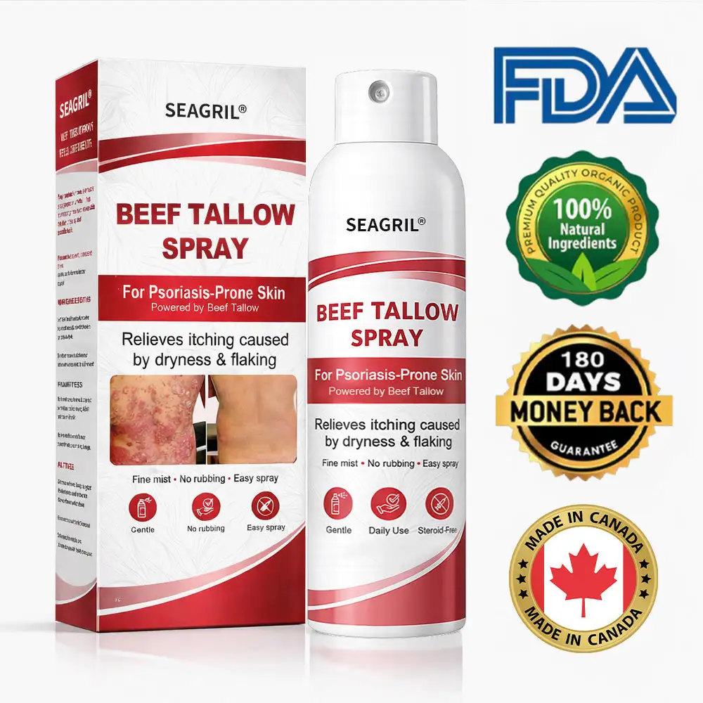 Beef Tallow Spray for Itchy, Flaky Psoriasis Skin