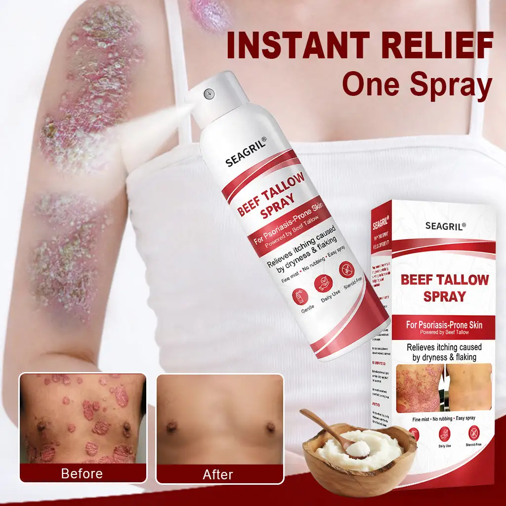 Beef Tallow Spray for Itchy, Flaky Psoriasis Skin - Image 2