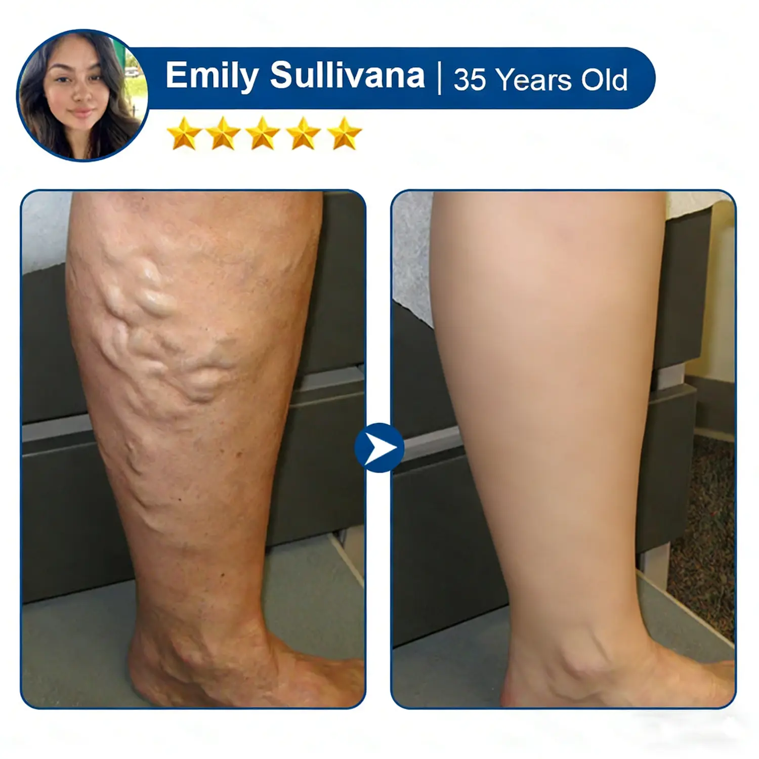 Vein Relief Patch|Smoother-Looking Legs - Image 10
