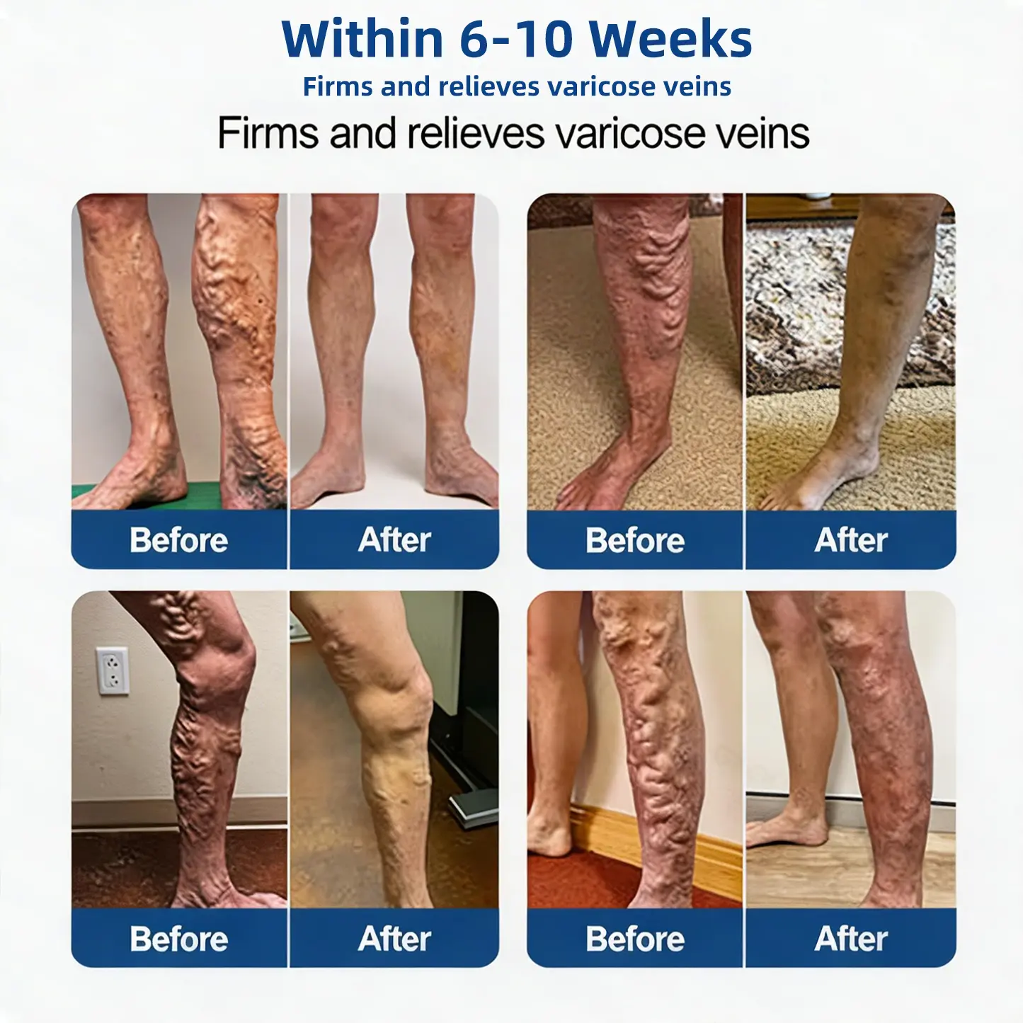 Vein Relief Patch|Smoother-Looking Legs - Image 6