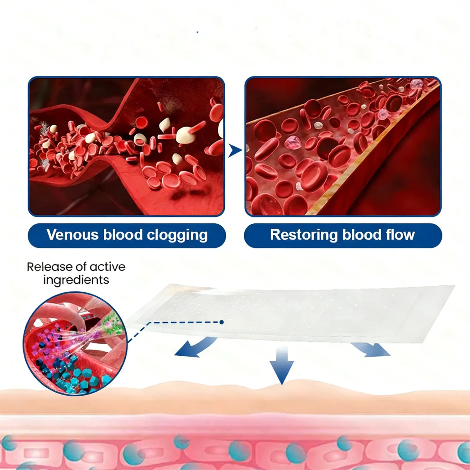 Vein Relief Patch|Smoother-Looking Legs - Image 9