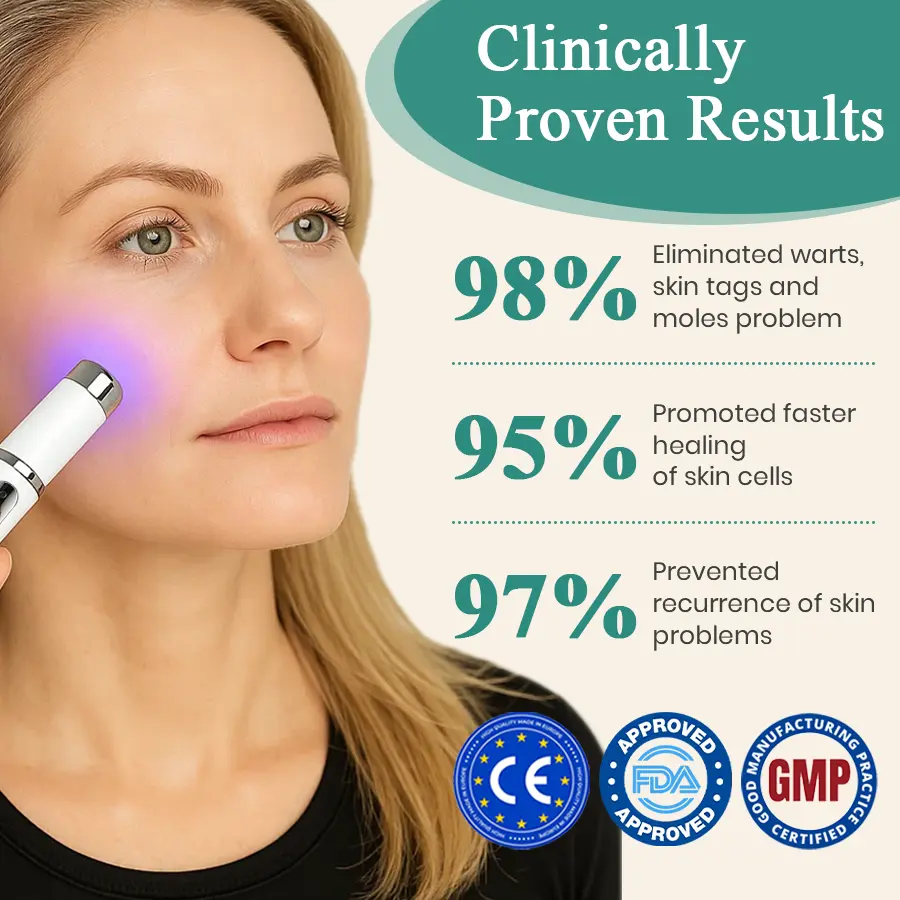 LumeSkin Mole and Wart Instant Removal Laser Pen ACE 5 - Image 3