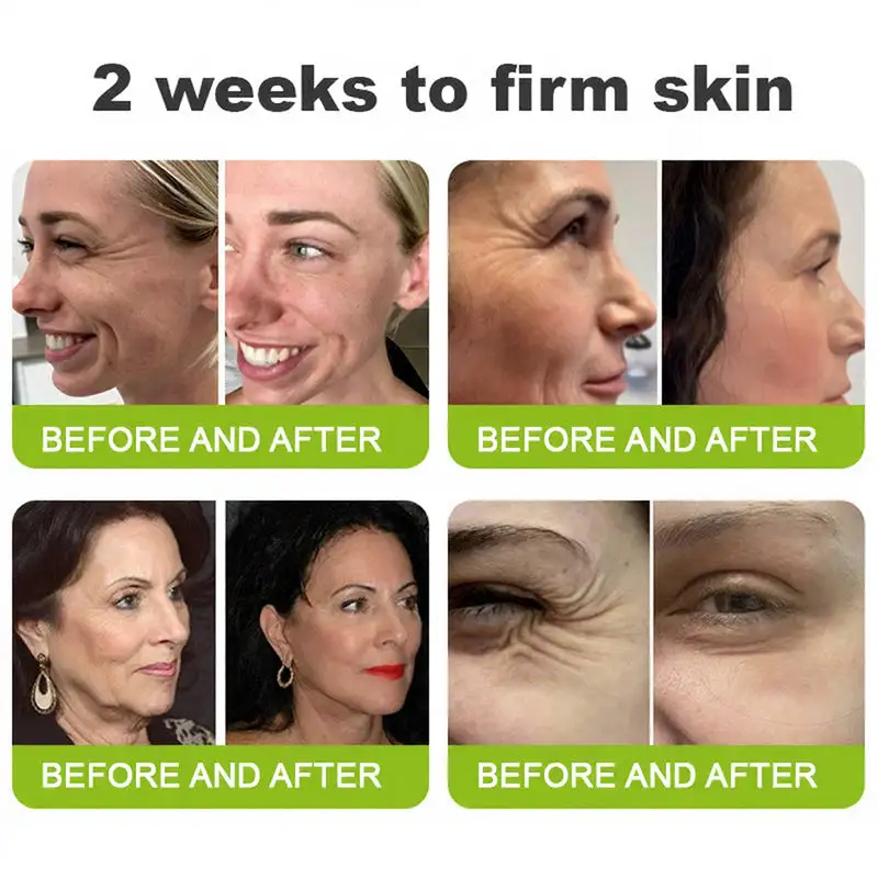 Skin Tightening & Vita-A Retinol Retinol shot Anti-Wrinkle Firming Tightening cream - Image 2