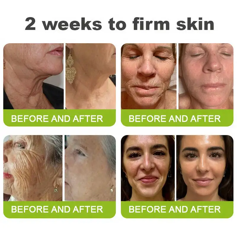 Skin Tightening & Vita-A Retinol Retinol shot Anti-Wrinkle Firming Tightening cream - Image 3