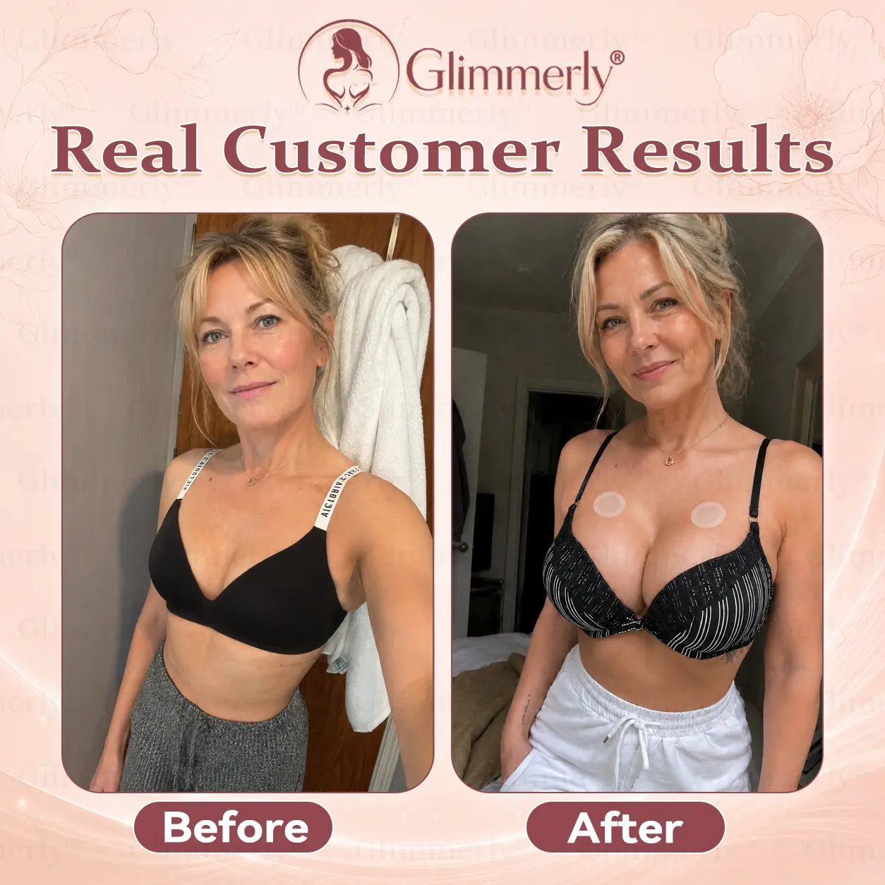 Breast Volume Boost & Firm Micro-Needle Patches - Image 2