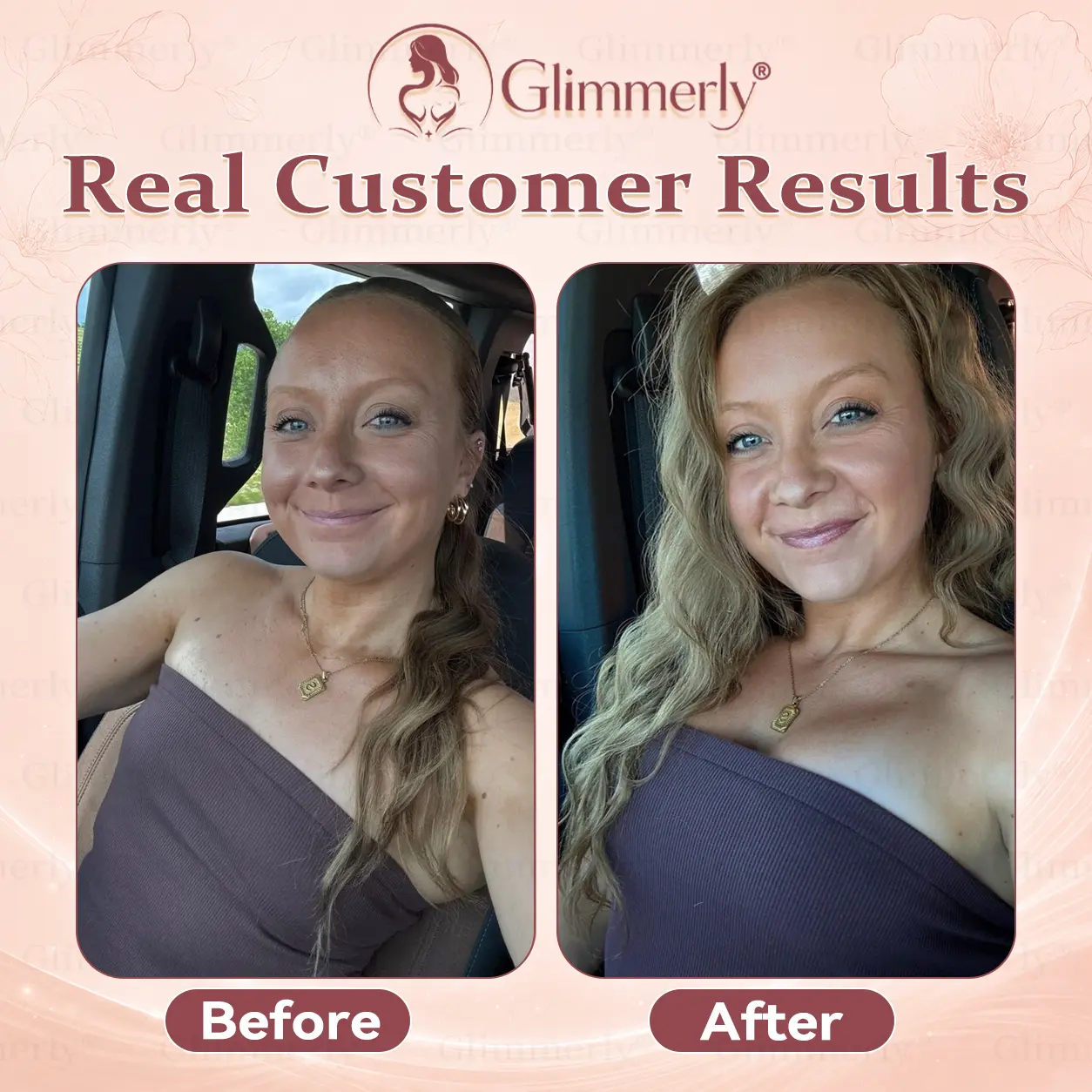 Breast Volume Boost & Firm Micro-Needle Patches - Image 3
