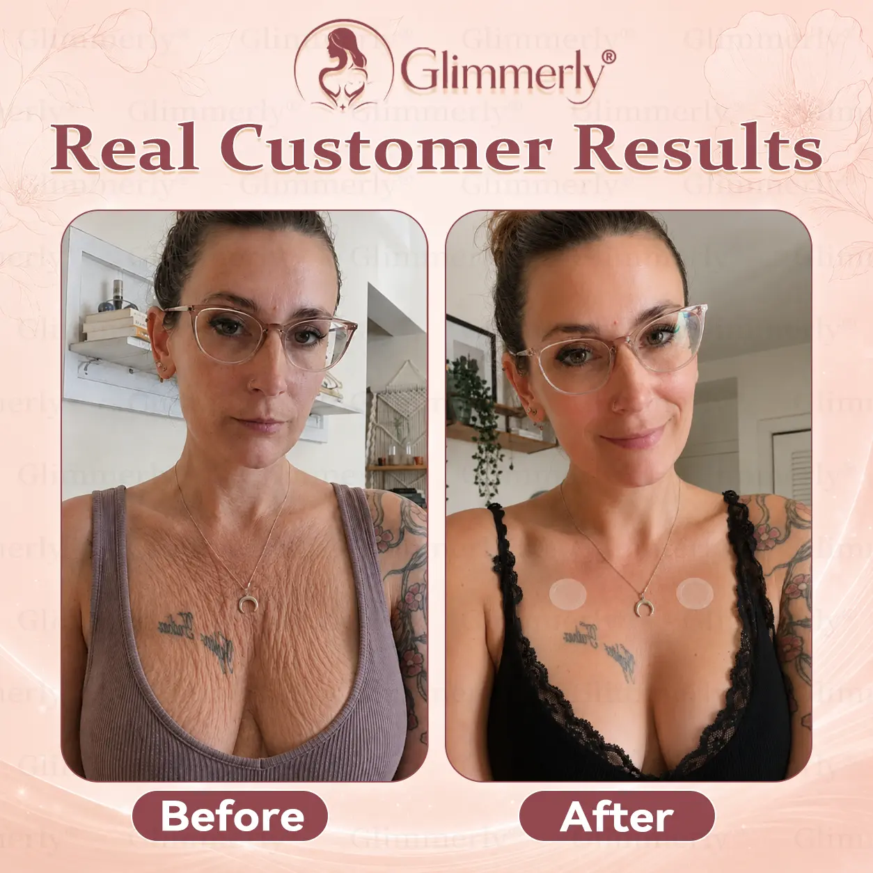 Breast Volume Boost & Firm Micro-Needle Patches - Image 5