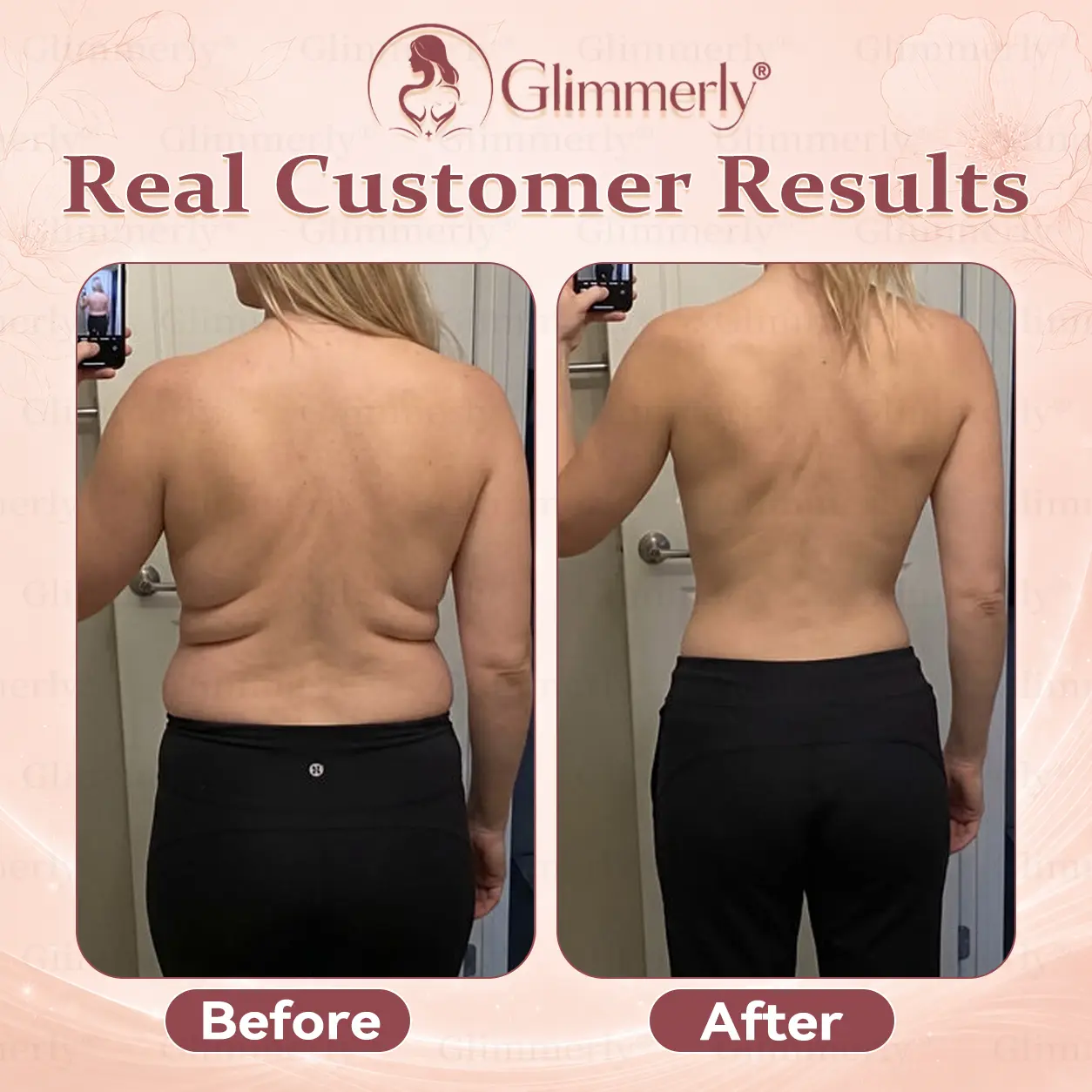 Breast Volume Boost & Firm Micro-Needle Patches - Image 7